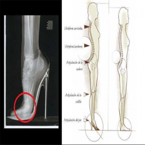 radiografia del pie